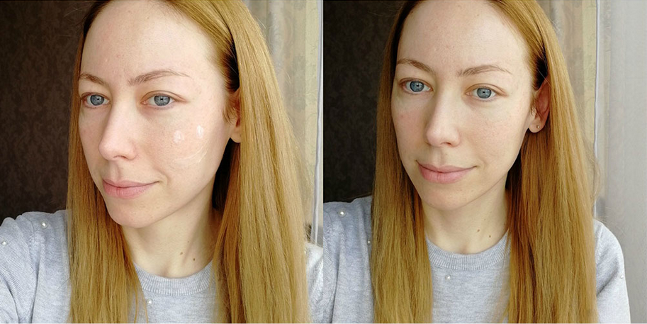 کرم هیالورونیک اسید کوزارکس کاسه ای