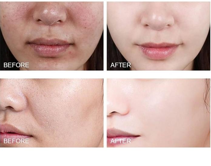 تونر آنوا ۷۷٪