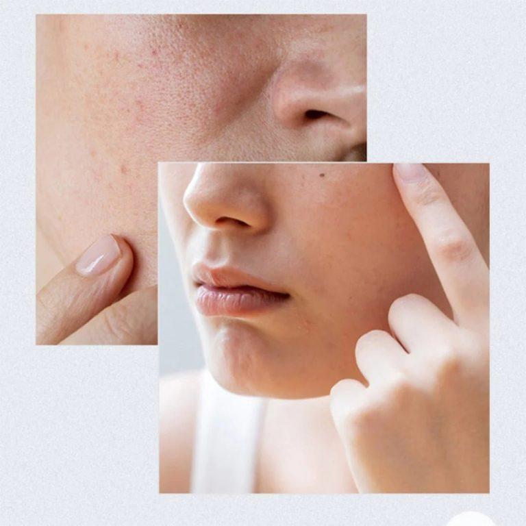 تونر پد مرطوب کننده آنوآ