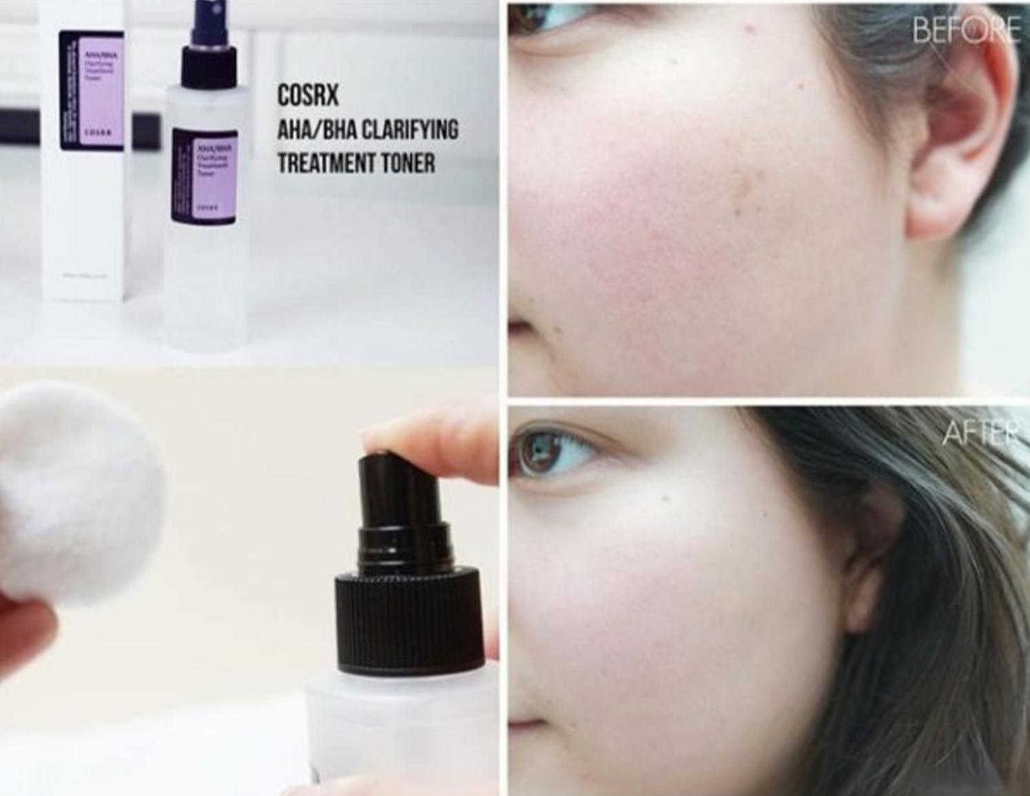 تونر AHA_BHAکوزارکس