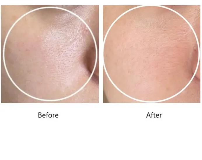 سرم ریدل شات 100 _50ml