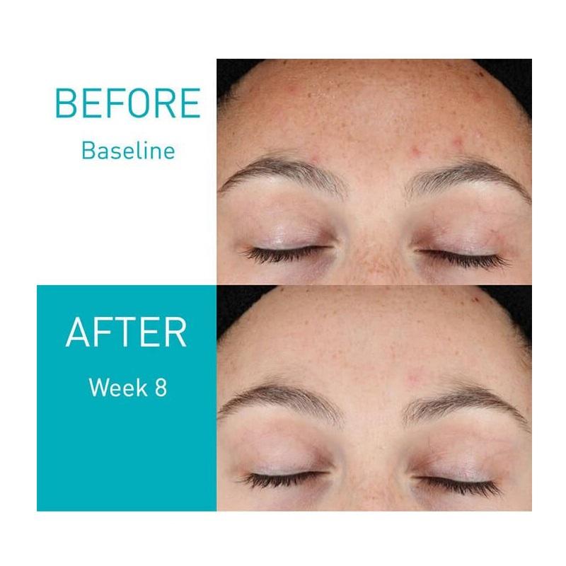 سرم رتینول سراوی