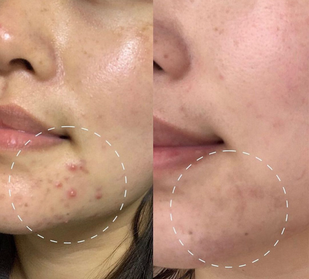 سرم ضد لک اکسیس وای