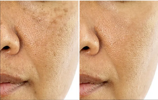 کرم ویتامین سی مدیکیوب